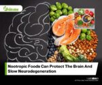 Nootropic Foods and Their Potential Impact on Progressive Neurodegenerative Diseases